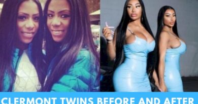 After Plastic Surgery, What Do The Clermont Twins Look Like Before And After-Featured